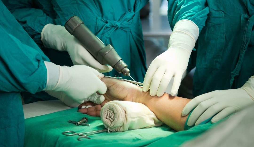 Best ortho Surgeon in Beeramguda 